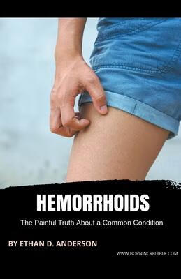预订 hemorrhoids: the painful truth about a common condition
