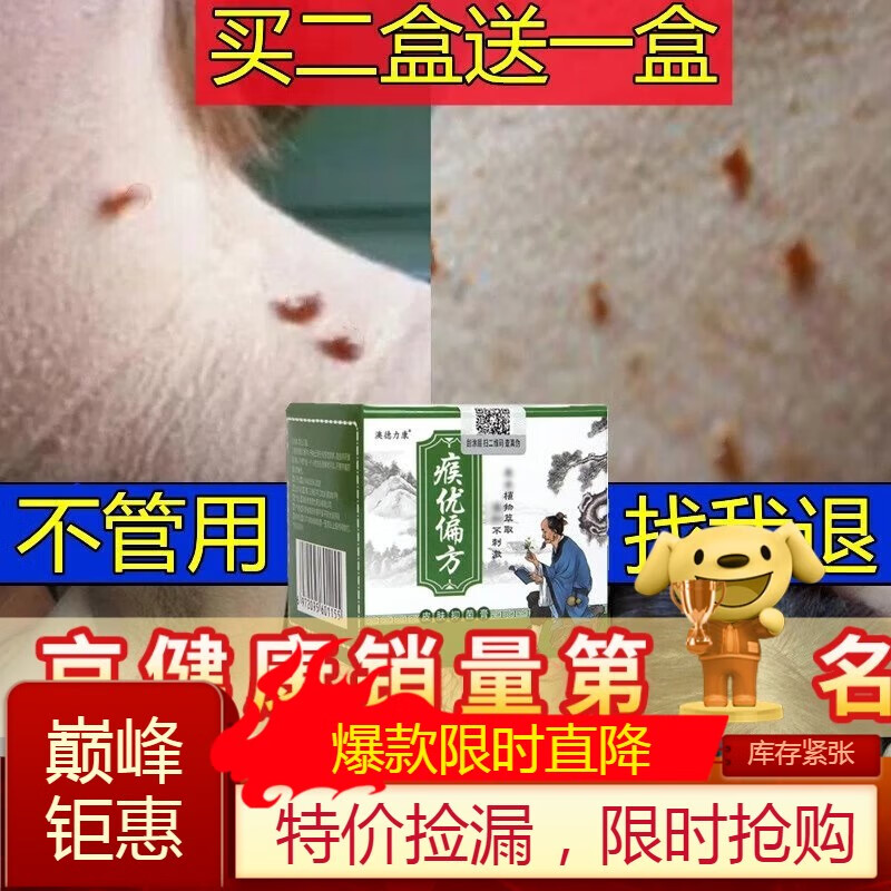 京健康祛瘊子痦子去除神器猴子皮赘药疙瘩肉瘤凸痣脖子上长小 肉 肉粒