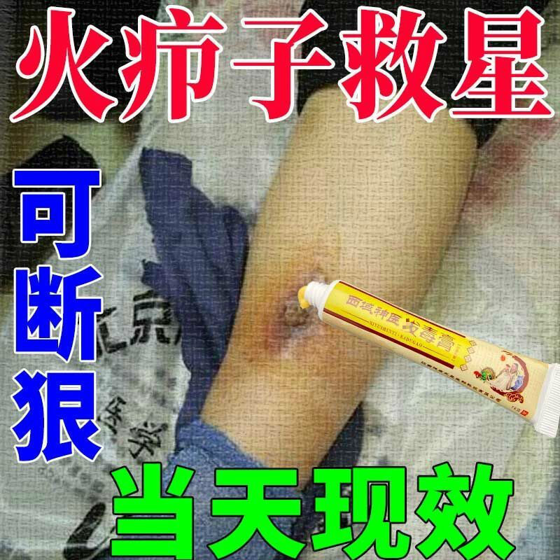 拔脓火疖子拔l毒膏贴火疙瘩脓包痘痘红肿痒疼痛流脓 6盒(买4送您2)
