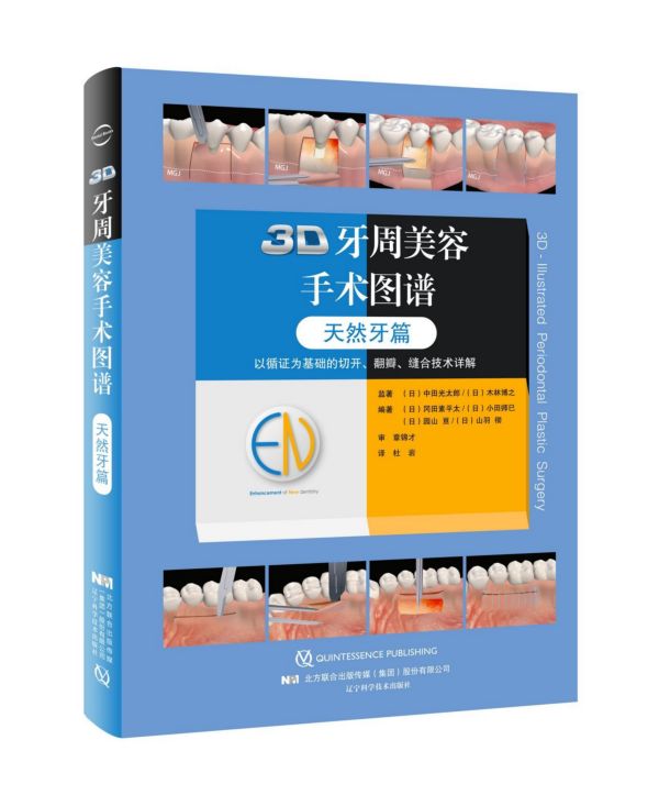 3D牙周美容手术图谱(天然牙篇)(精)