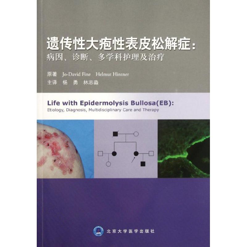 遗传性大疱性表皮松解症:病因.诊断.多学科护理及治疗