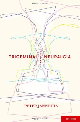 预订 trigeminal neuralgia