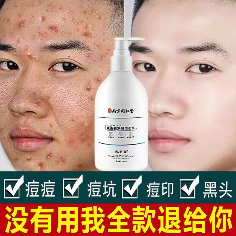 南京同仁堂氨基酸洗面奶洗面乳控油抗痘祛痘印去黑头除螨收缩毛孔补水男女士 一瓶装300ml【下单2瓶到手3瓶】