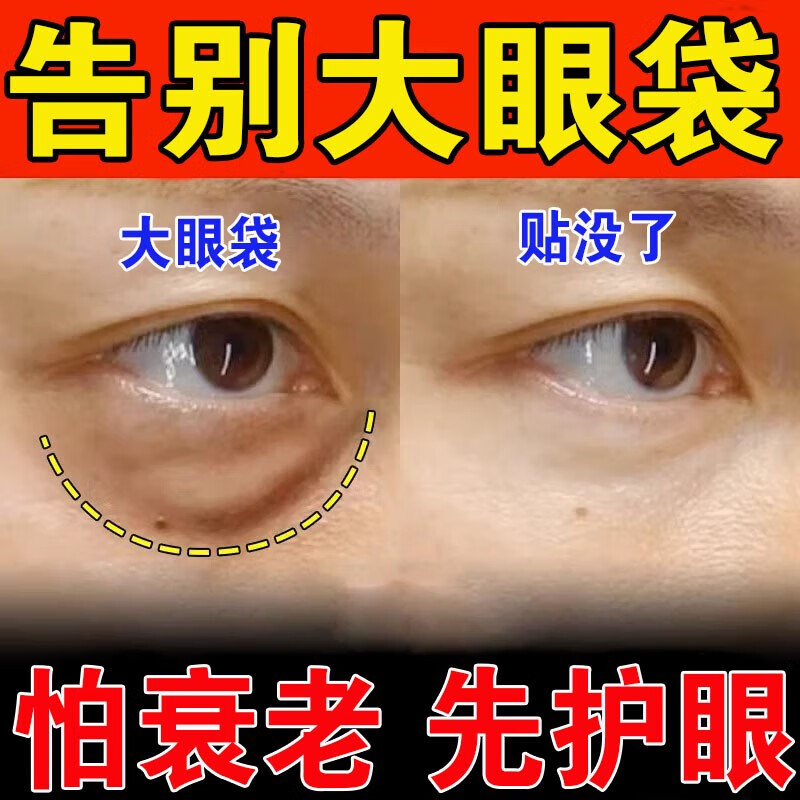 眼袋消除男士女士专用眼贴去除神器严重水肿黑眼圈淡化细纹皱纹中 单