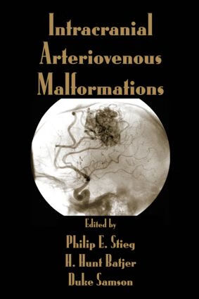 预订 intracranial arteriovenous malformations