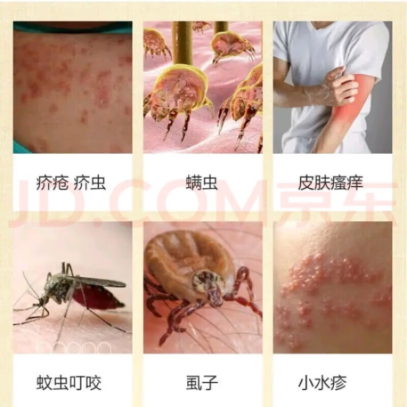 祖郎中硫磺软膏螨虫洗浴膏阴虱阴囊牛黄清肌过敏皮肤热痒私处止奇痒
 买3+2【五盒巩固装】