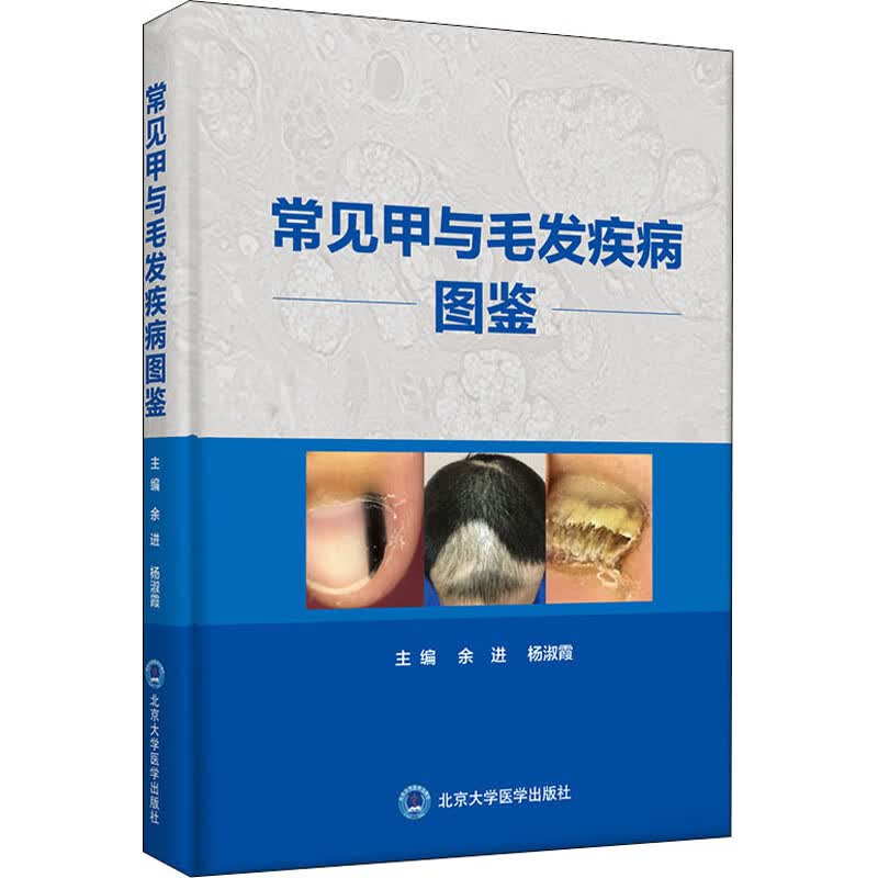 正版 常见甲与毛发疾病图鉴 作者 北京大学医学出版社