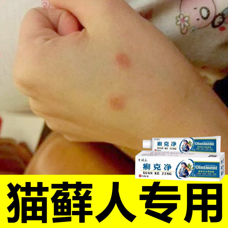 猫癣人用膏除猫癣的人用人得猫藓真菌水疱止痒膏 人用猫癣膏  1盒