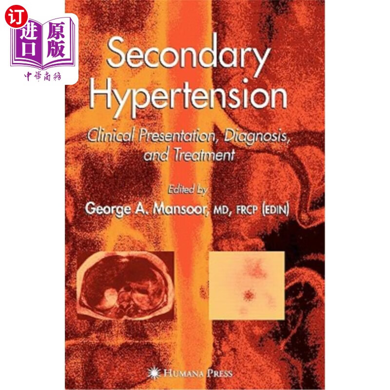 海外直订医药图书secondary hypertension: clinical presentation
