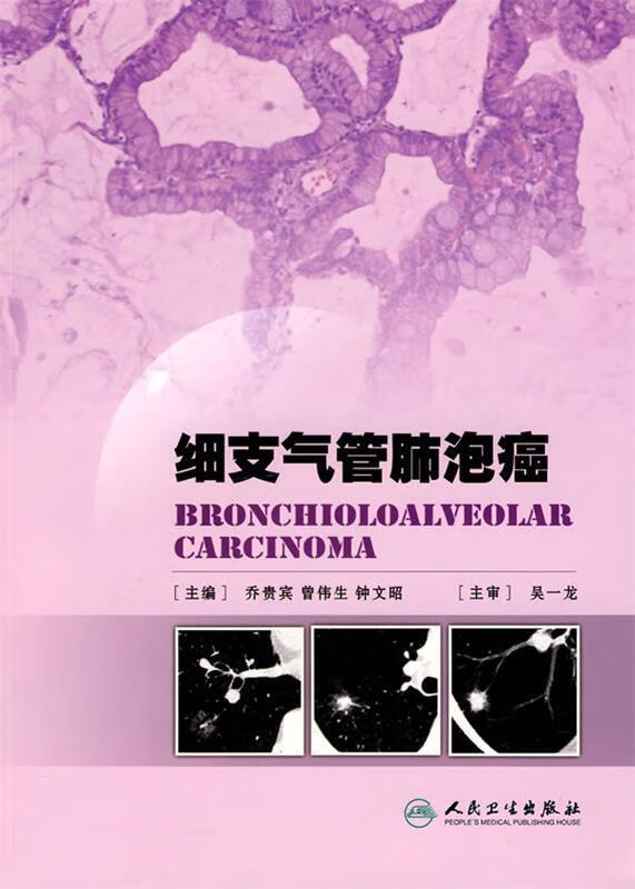 细支气管肺泡癌