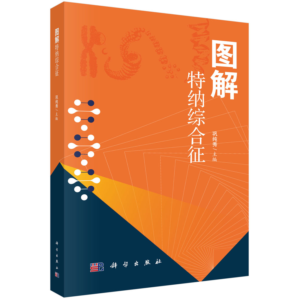 图解特纳综合征《现货速发》