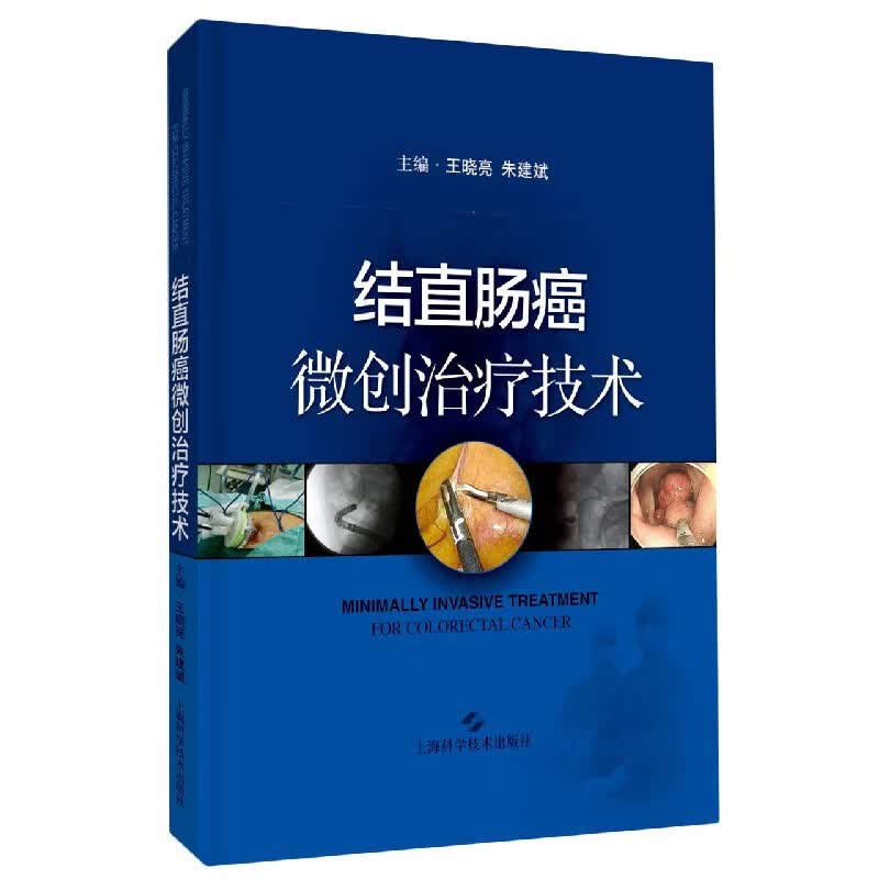 结直肠癌微创治疗技术(精)