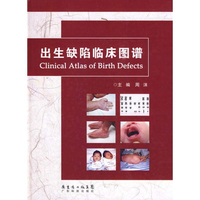 出生缺陷临床图谱 周沫 作 书籍