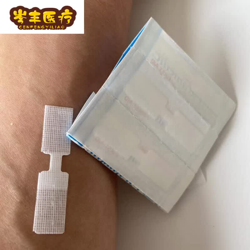 免缝胶带 免缝针减张器拉链式免缝胶带皮肤伤口减张贴拉合缝合贴 m 10