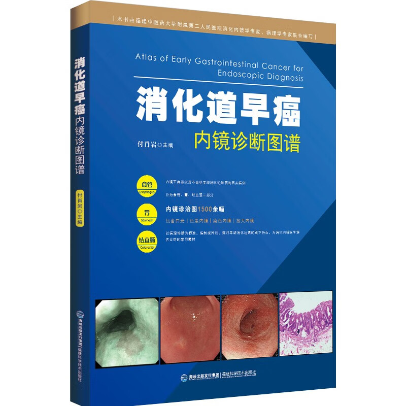 消化道早癌内镜诊断图谱