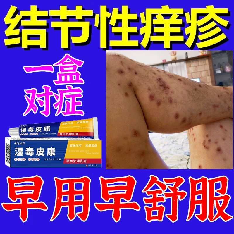 结节性痒疹痒全身皮肤瘙痒结节红肿皮炎湿疹过敏性疹痒膏 单盒装