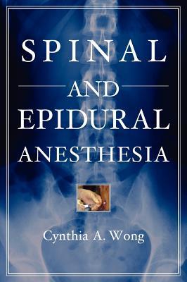 预订spinal and epidural anesthesia