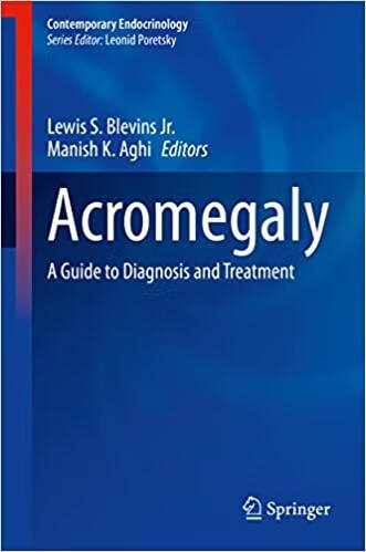 预订 acromegaly: a guide to diagnosis and treatment