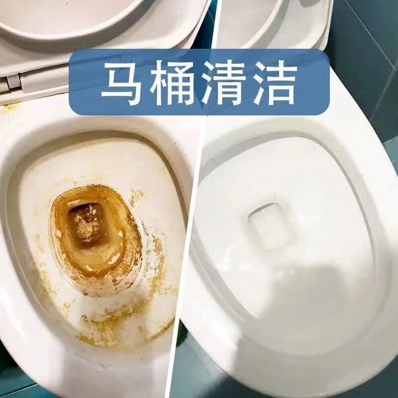 妙语诺马桶清洁神器去污垢尿碱异味除垢剂厕所除臭清洁剂强力去黄洁厕灵5包装 去尿垢 去异味 马桶清洁 绝对值 居家 绝对值 妙语诺马桶清洁神器去污垢尿碱异味除垢剂厕所除臭清洁剂强力去黄洁厕灵5包装 去尿垢 去异味 马桶清洁 绝对值 居家 绝对值