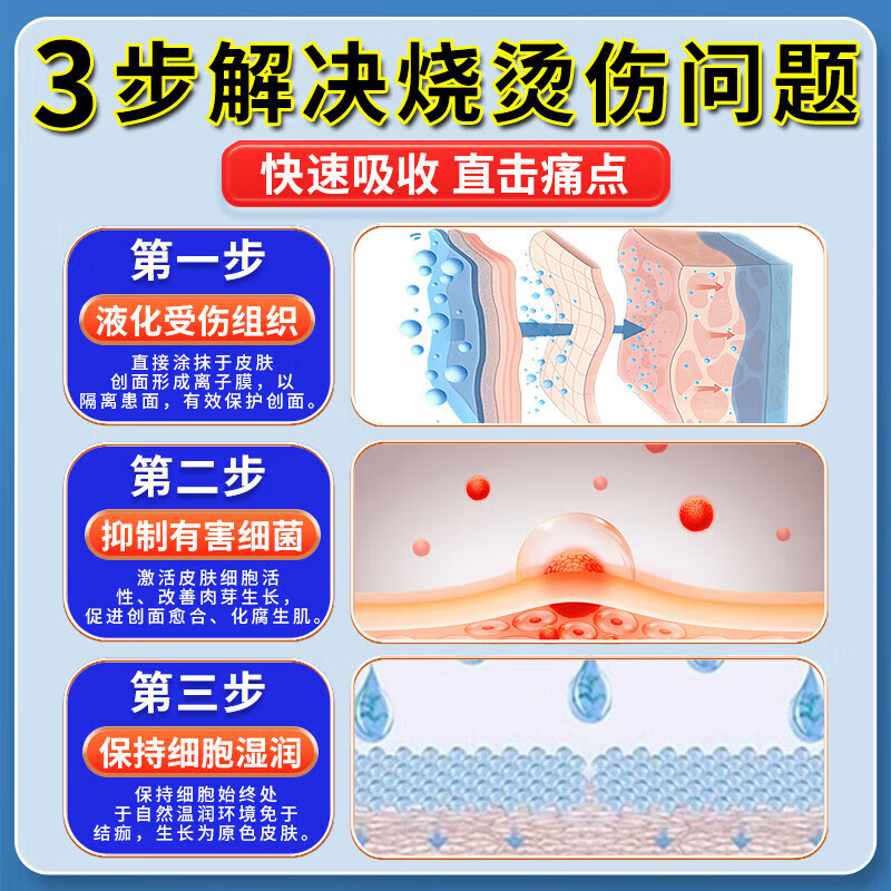 美宝美宝烫伤膏疤痕修复烫伤膏湿润烧伤膏热油开水烫伤特效美宝烧伤膏 一盒