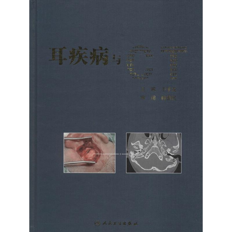 耳疾病与CT