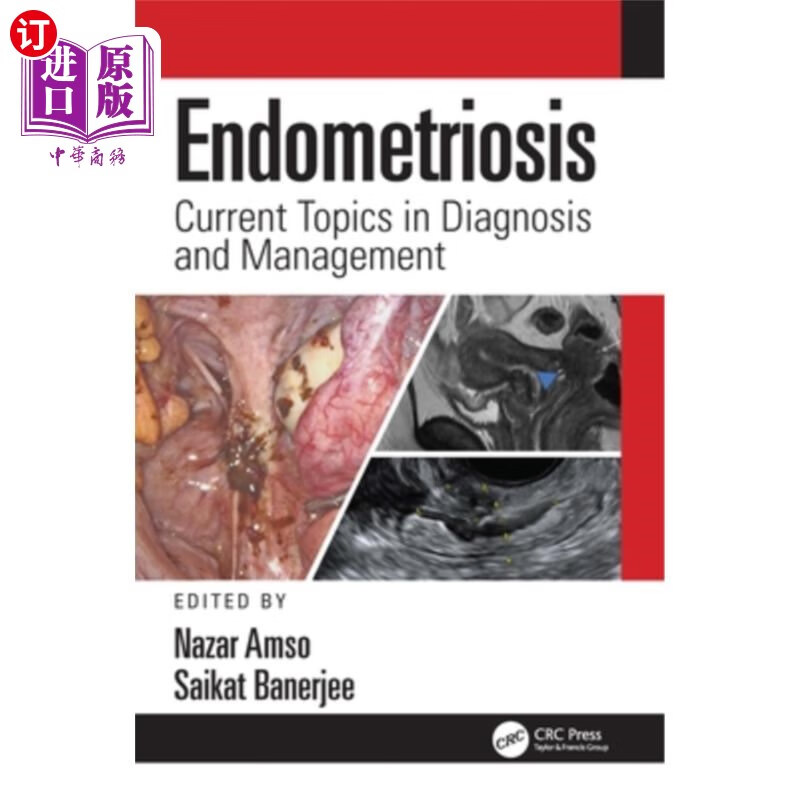 海外直订医药图书endometriosis: current topics in diagnosis and