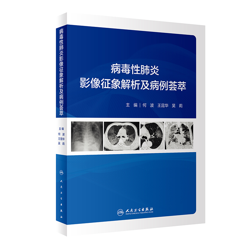 病毒性肺炎影像征象解析及病例荟萃