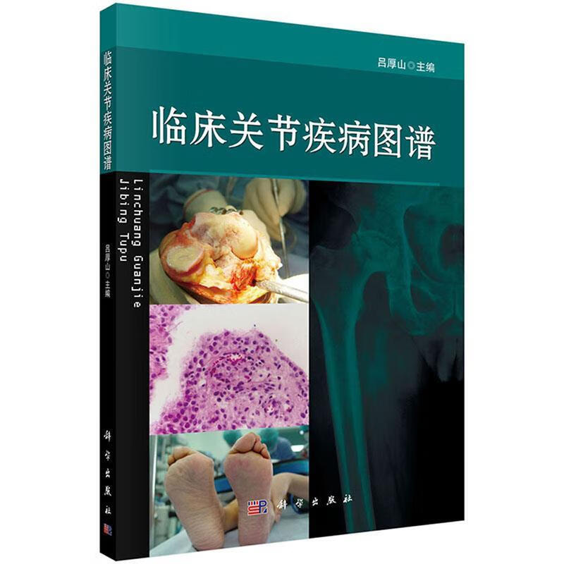 & 临床关节疾病图谱 吕厚山,孙铁铮 科学出版社