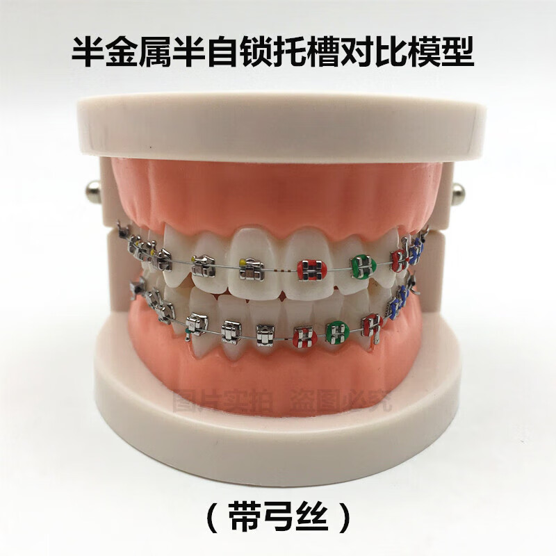 牙科正畸带托槽假牙模型 医患沟通教学模型 矫正练习托槽模型 结扎丝