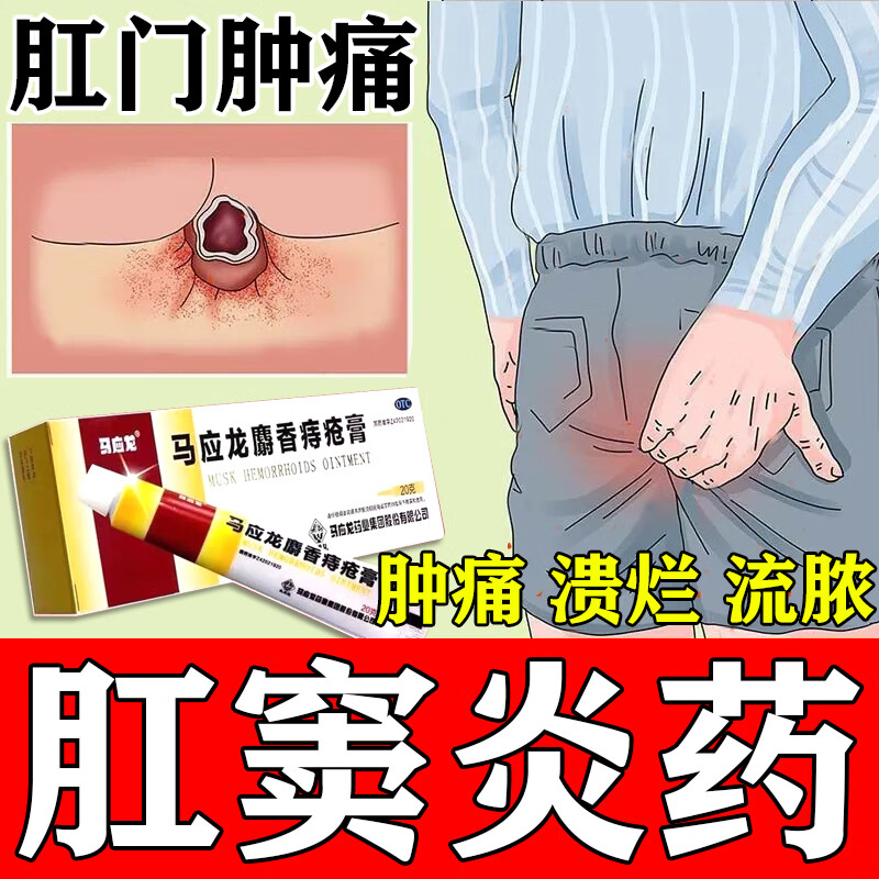 肛窦炎专用药肛周脓肿肛门坠胀疼痛肛隐窝感染大便出血肛窝发炎肛门