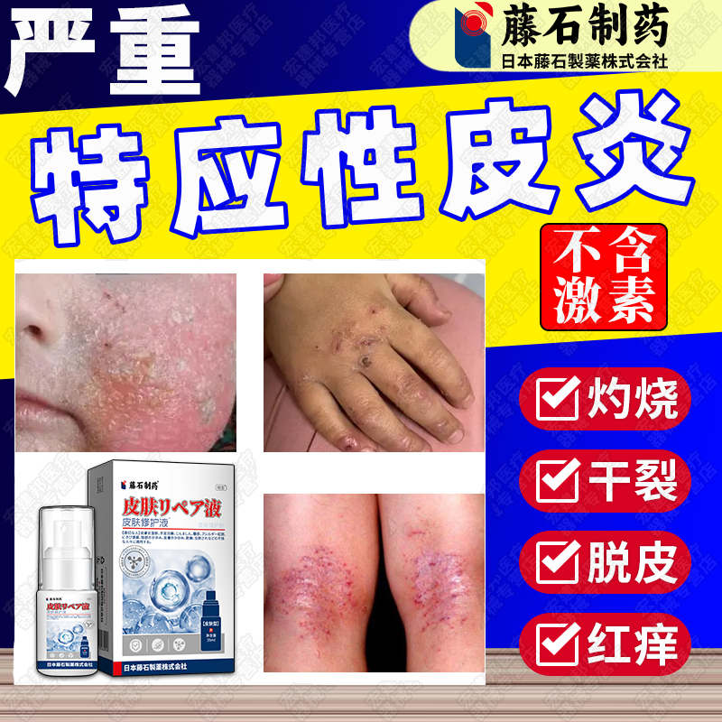 儿童特应性皮炎止i痒喷剂用药的膏敏感肌身体乳保湿滋润干性湿疹抑菌