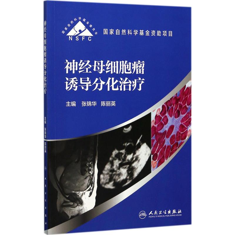神经母细胞瘤诱导分化治疗