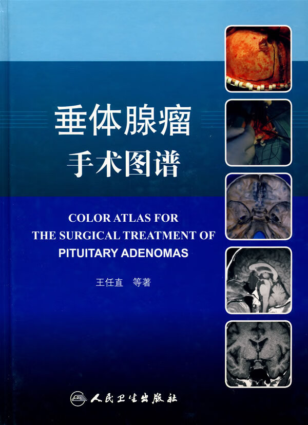 垂体腺瘤手术图谱【正版图书】