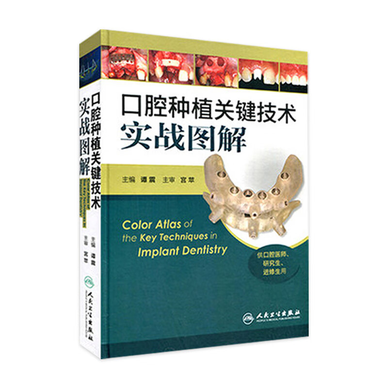 口腔种植关键技术实战图解  谭震  9787117186186 临床医生必读
