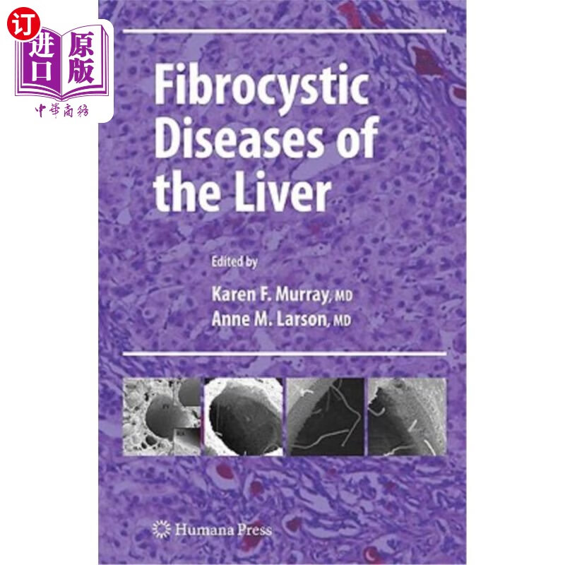 海外直订医药图书fibrocystic diseases of the liver 肝脏纤维囊性