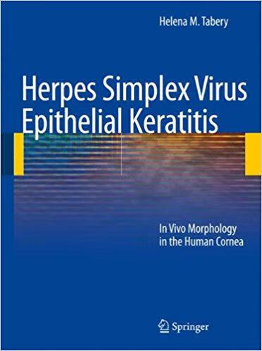 预订 herpes simplex virus epithelial keratitis