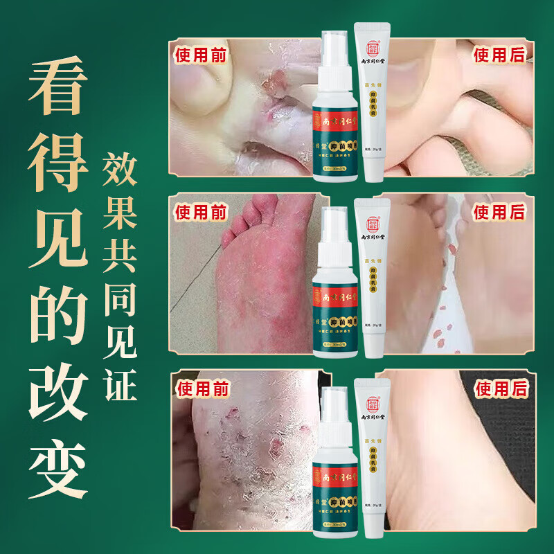 乐家老铺脚臭脚痒脱皮脚丫膏止氧净喷剂瓶/30ml 30ml喷剂