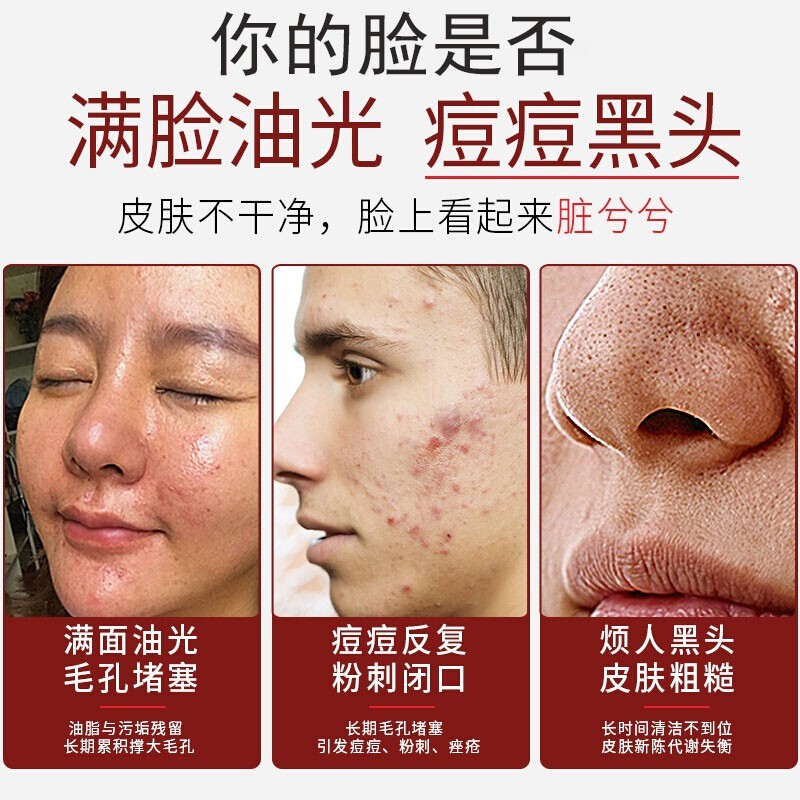 九叶草 氨基酸洗面奶男女男士洗面奶除螨控油去黑头去角质收缩毛孔倩滋 1瓶装【脸上瘙痒出油长痘螨虫在作怪】 脸上瘙痒出油长痘螨虫在作怪