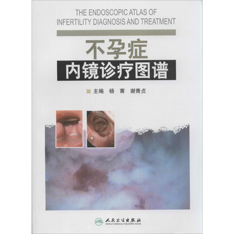不孕症内镜诊疗图谱  书籍