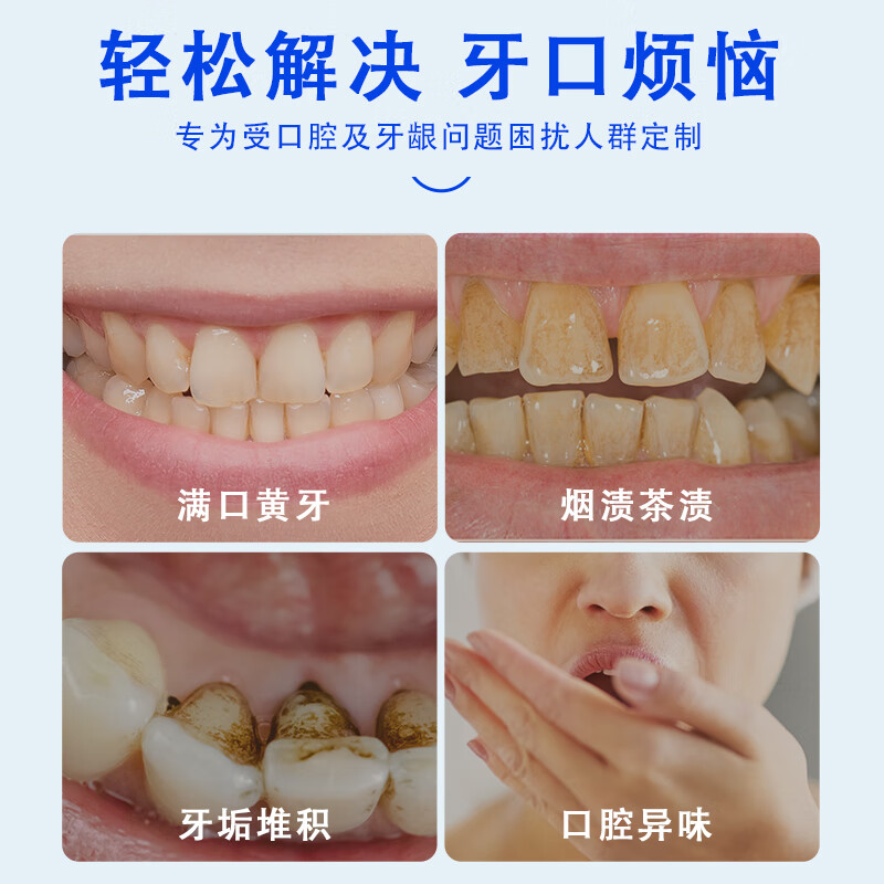 可立克深导白蜂毒牙膏净齿修护150min清新气激爽薄荷香型减少牙菌斑异味 【三支装】深导白105g*3