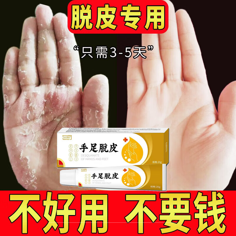 手脱皮季节性修复霜手掌手指头蜕皮开裂干裂维生素手起皮掉皮爆皮 一