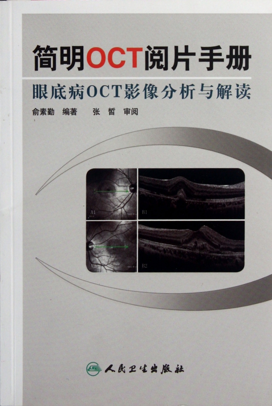 简明OCT阅片手册(眼底病OCT影像分析与解读)
