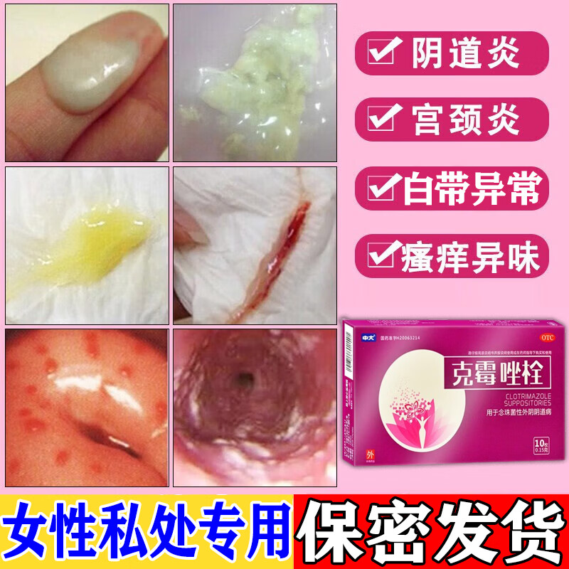种妇科炎症凝胶私处瘙痒外阴瘙痒专用药白带多发黄豆腐渣异味克霉唑栓