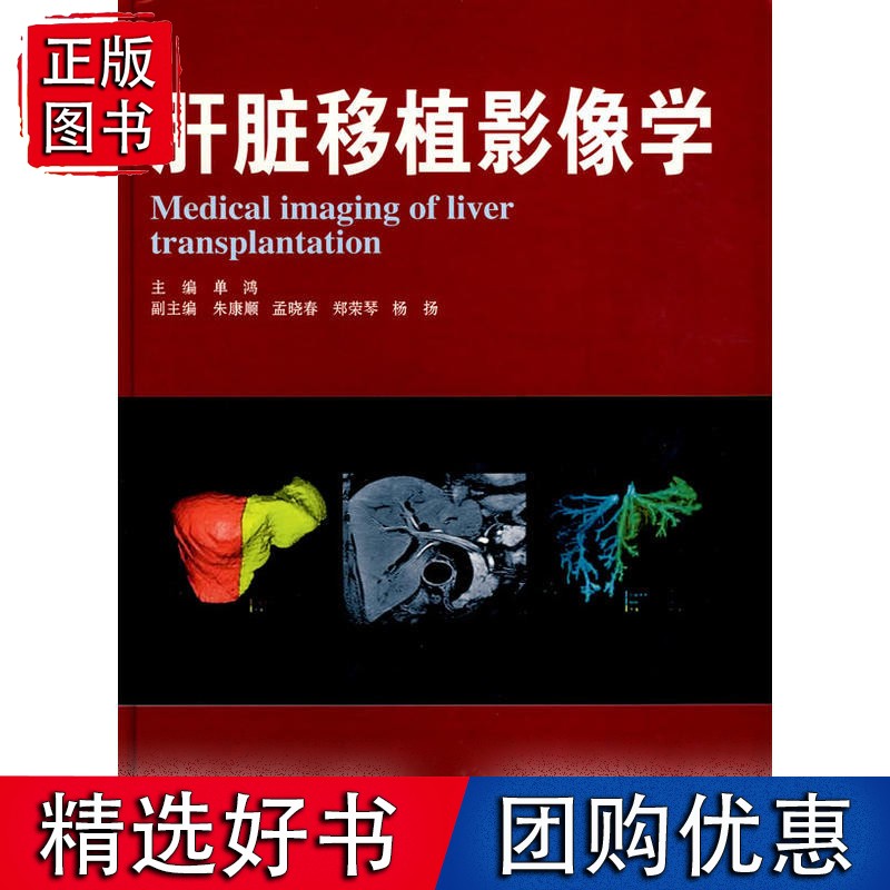 肝脏移植影像学
