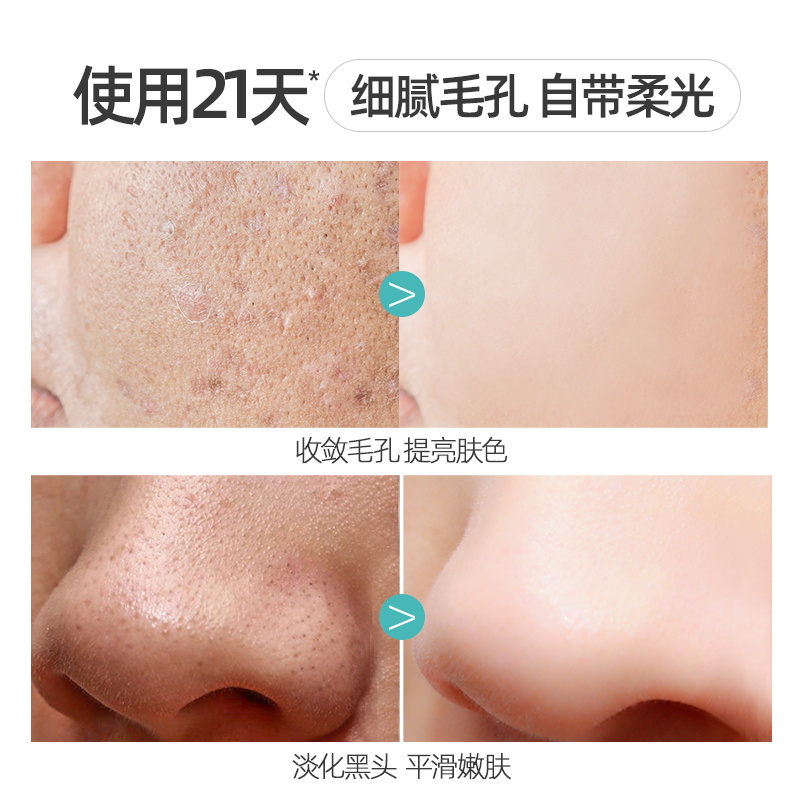 fUT粗大毛孔别挤！收缩毛孔精华液乳糖酸原液去改善黑头闭口控油男女 收缩毛孔精华液【1盒装】
