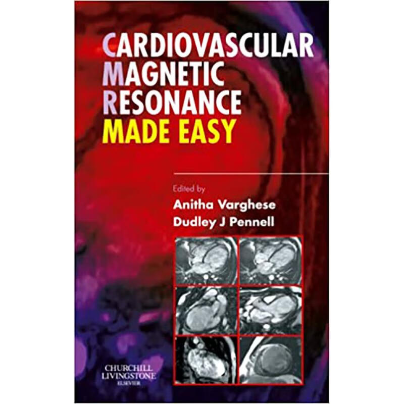 预订cardiovascular magnetic resonance made easy