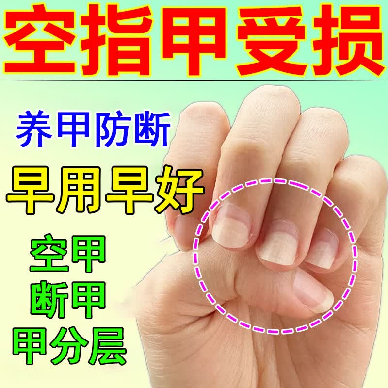 geox【官方】指甲修复生长液促进生长指甲营养液甲床分离肉包甲空甲薄