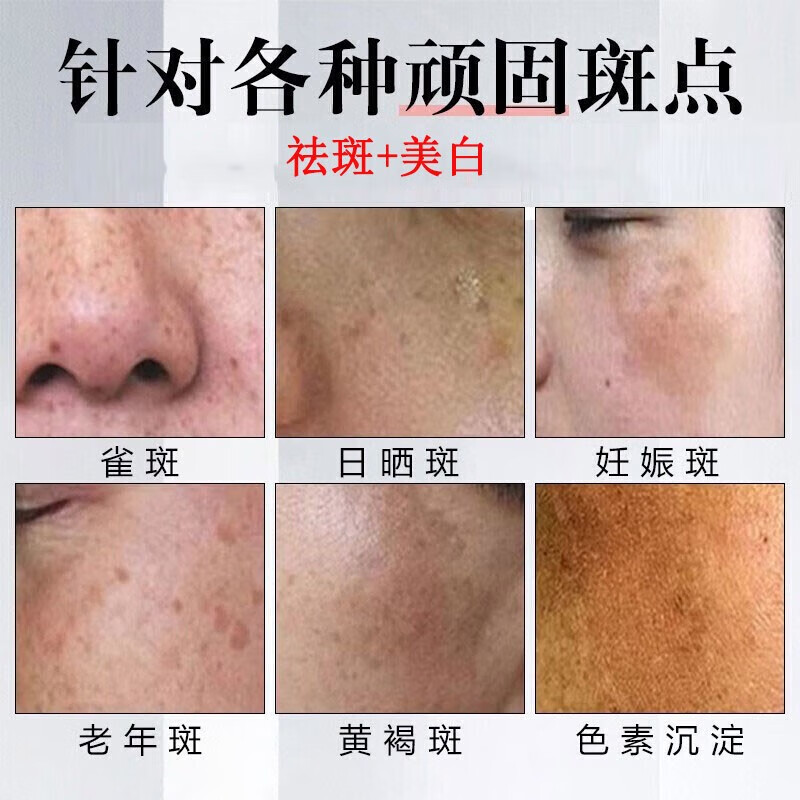 白云山星群美白祛斑洗面奶淡斑各种斑点黄暗提亮肤色深层清洁保湿洁面乳男女 1瓶装【推荐2瓶划算】
