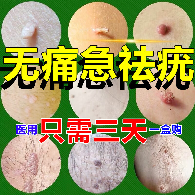 维a酸乳膏 扁平疣药膏 去猴子扁丝状疣一抹灵去疣灵扁平疣面部专用药