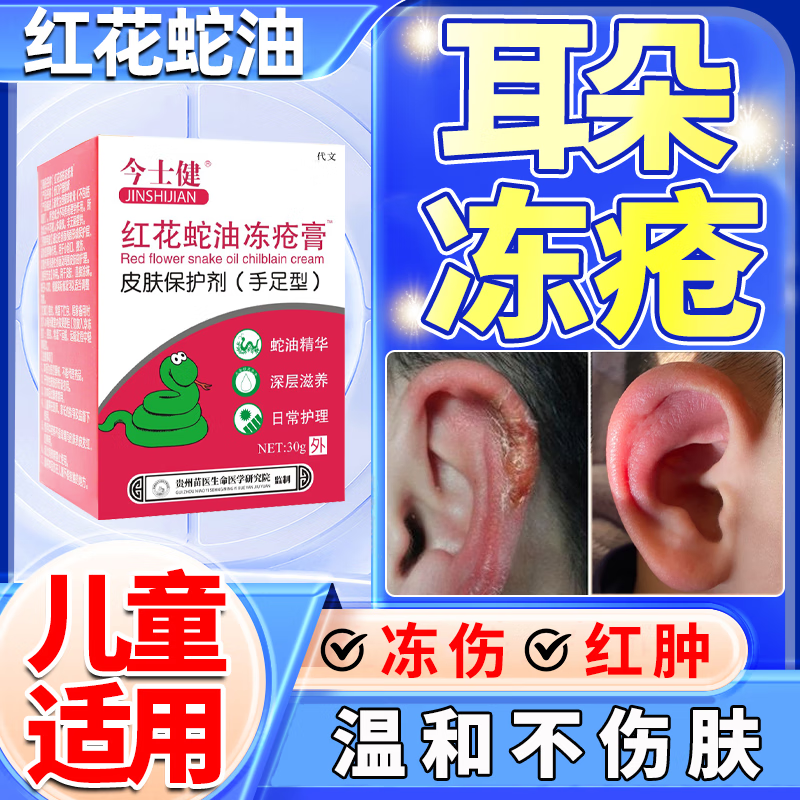 耳朵干裂脱皮[一盒装]